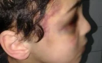 Un garçon de cinq ans violé et torturé par sa mère adoptive