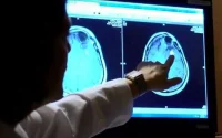 Un Marocain met au point un traitement révolutionnaire contre le Cancer